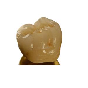Quality Inter Miscibility Porcelain Dental Crown wholesale