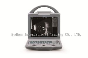 Quality Double probe sockets Full digital A/B scan portable cheapest Ophthalmic Ultrasound wholesale