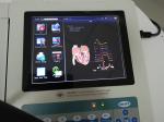 Hospital Digital 12 Channel Ecg Machine Electrocardiograph Ecg Prices