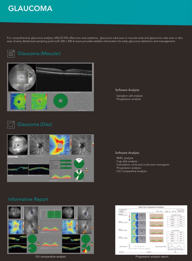 factory price hot selling Advanced OCT Ophthalmic OCT Optical Coherence Tomography