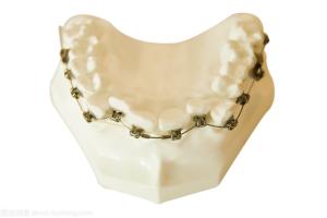 Quality Dental Brackets Orthodontics Fixed Tooth Modeling Tools Dental Braces wholesale