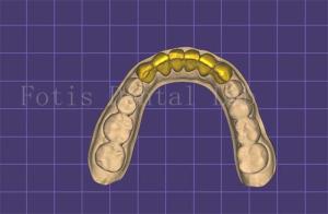 Quality Customizable Dental Mouth Model Maker Autoclavable FDA Approved wholesale