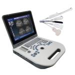 Xianfeng Laptop USG Scan Machine Ultrasound Device Li-Ion 6.5MHz R13