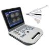 Buy cheap TGC Control Notebook Ultrasound Scanner For Pregnancy Home Use from wholesalers
