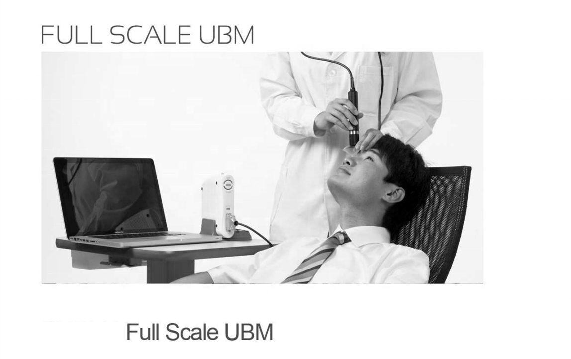 Portable Panoramic Full Scale Ultrasound Bio-microscope UBM Opthalmology