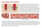New product ideas 40W medical fractional CO2 laser for Acne removal and scar