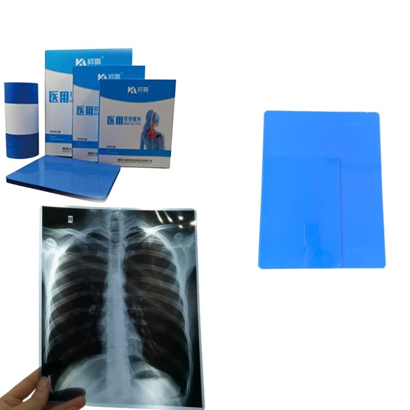 8x10 10x12 10x14 14x17 Inch Medical Dry DIHL Film Laser Xray Film For Clinic And Hospitals