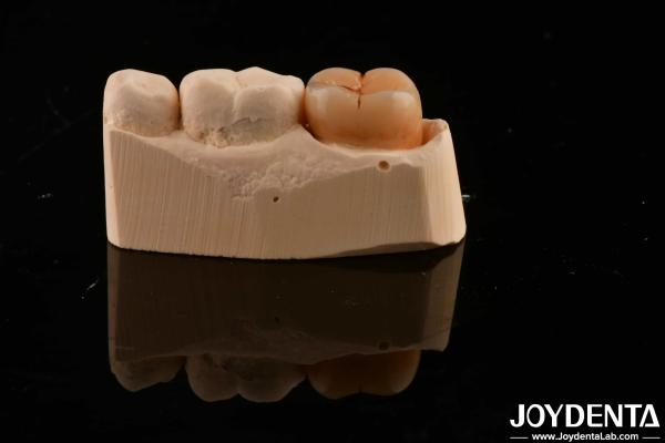 Dental Restoration Material Multilayer Full Zirconia 1200 HV Hardness Crack