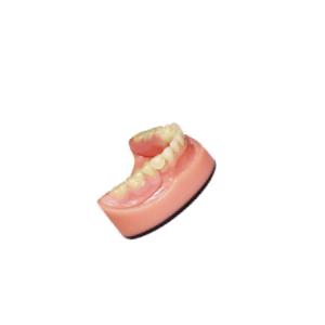 Quality Denture Dental lab PFM Dental Bridge 3D Digital Intraoral Scanning Imaging System wholesale