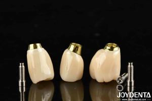 Quality High Durability White Finish Implant Crown And Bridge With Accurate Fit wholesale