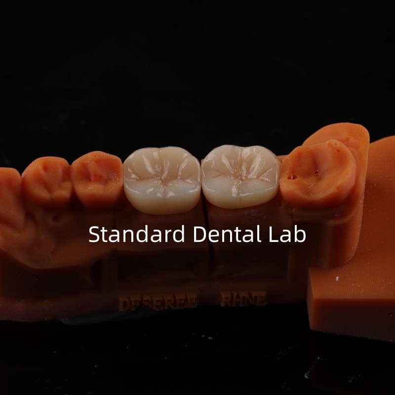 Full Contour Zirconia Crown Translucency 3D PRO No Porcelian Overlay Standard Dental Lab