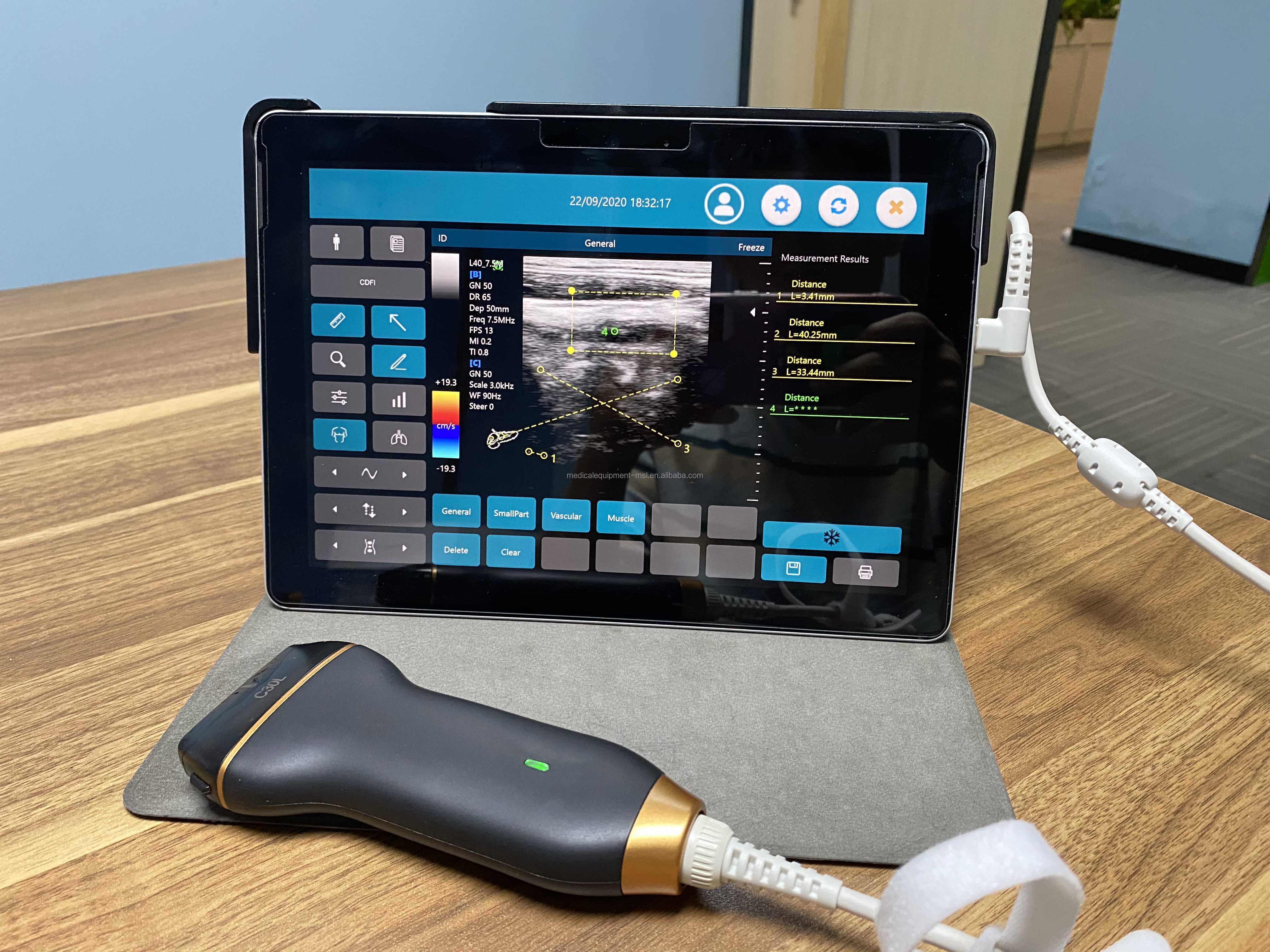 Mobile Smart USB Color Doppler Ultrasound Probe For Laptop