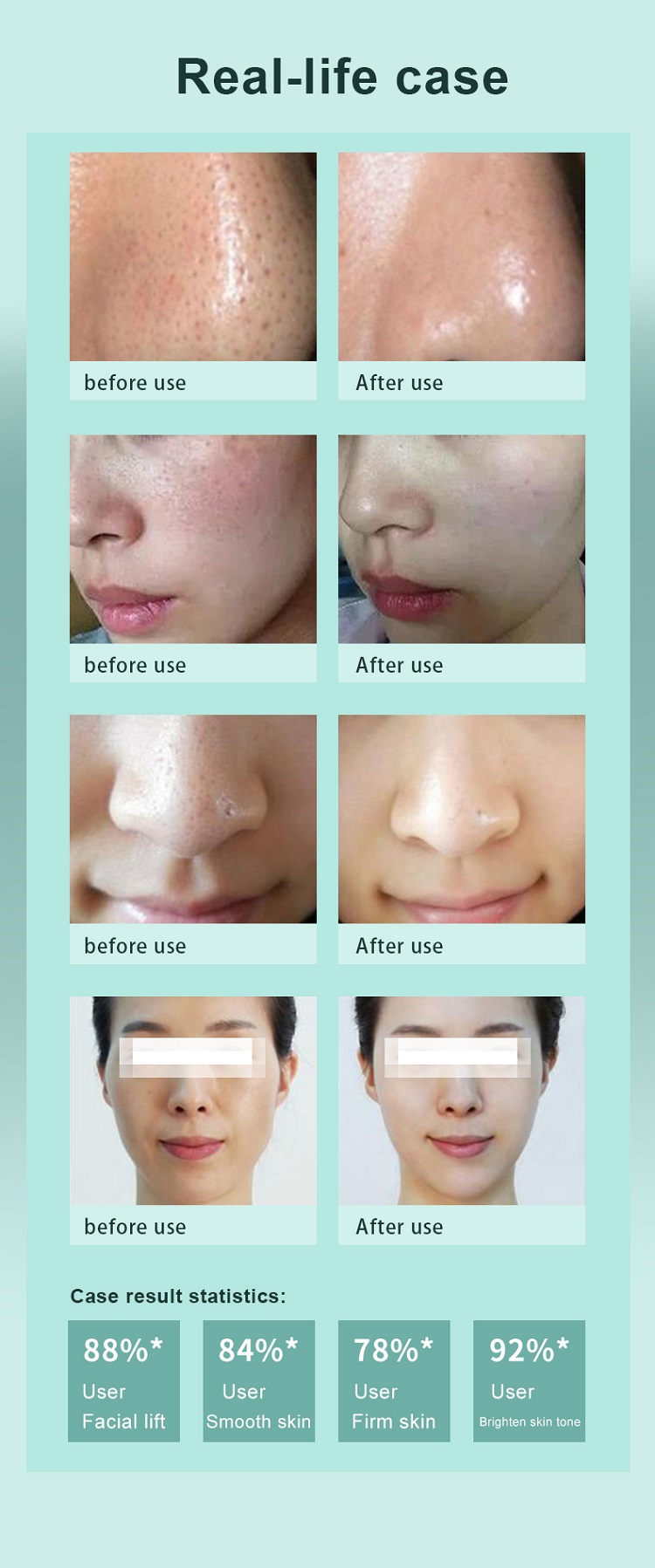 7 Handles Hydrodermabrasion And Oxygen Machine 250W Hydrotherapy Facial Machine 90Kpa