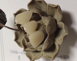 Quality Natural Colour Resin Based Composite Crowns wholesale