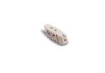 Lumbar Fusion Cornerstone Peek Cage Spinal Fusion Surgery Tlif Peek Cage