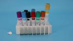 95kPa White Round Bottom Centrifuge Tubes Biohazard Sample Bags