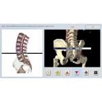 V16 Metatron NLS Software Bioresonance Diagnostics Therapy Machine Biofeedback
