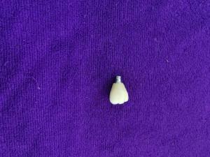 Quality Single Tooth Trushine OSSETEM Dental Implants Fixture Level wholesale