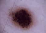Wifi Skin Video Dermatoscope 2.5W For 3 Hours