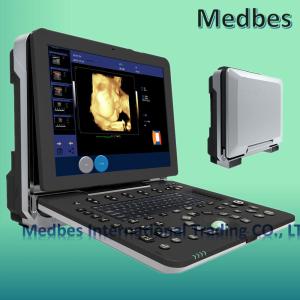 Quality Hospital 3D Fetal doppler Ultrasound Scanner Ultrasound Machine wholesale