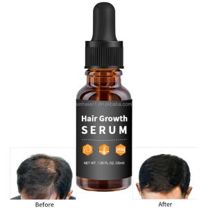 Quality Customization Hair Growth Treatment Serum for Black Women Private Label wholesale