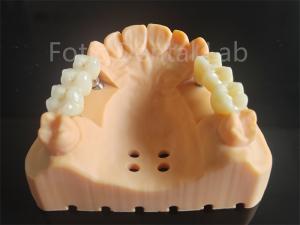 Quality Customized Full Contour Zirconia Layered With Porcelain Dental Material wholesale