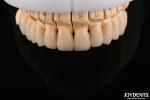 Polished Surface Flexural Strength Layered Zirconia for Bridges 6.0-6.1 G/cm3