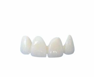 Quality Easy Cleaning All Ceramic Crowns Transparent Natural Shade Customizable wholesale