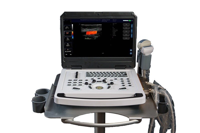 CE Portable Color Doppler Ultrasound Machine Scanner OEM