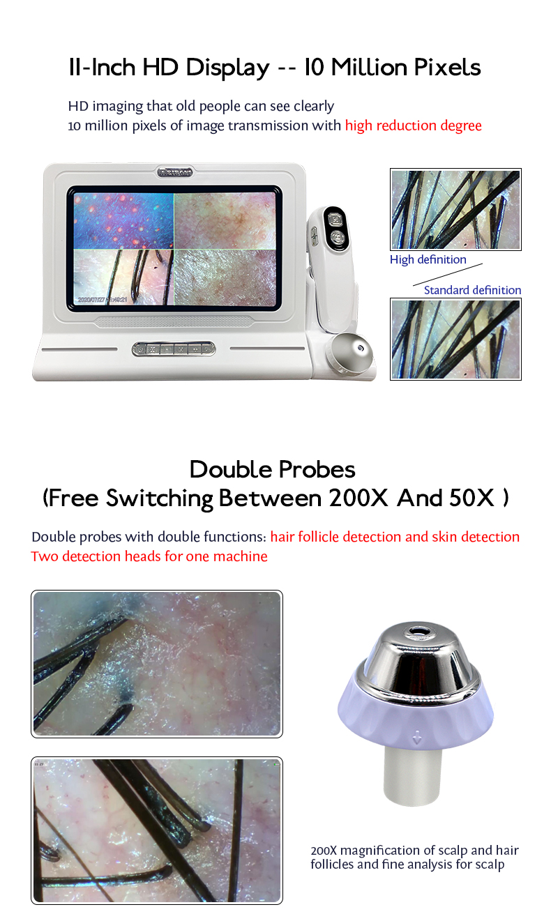 Portable Scalp Scanner for Professional Hair Analysis in Beauty Salon 3KG/36*29*21CM