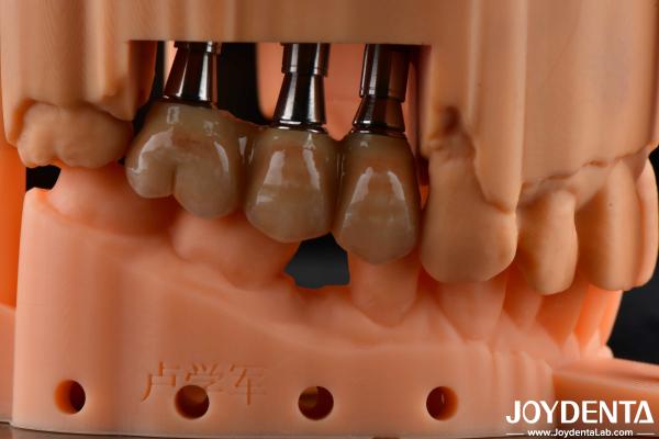 High Flexural Strength Multilayer Full Zirconia Dental Solution Full Arch