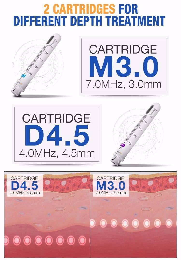 2018 Korea Skin Tightening hifu vaginal 3 in 1