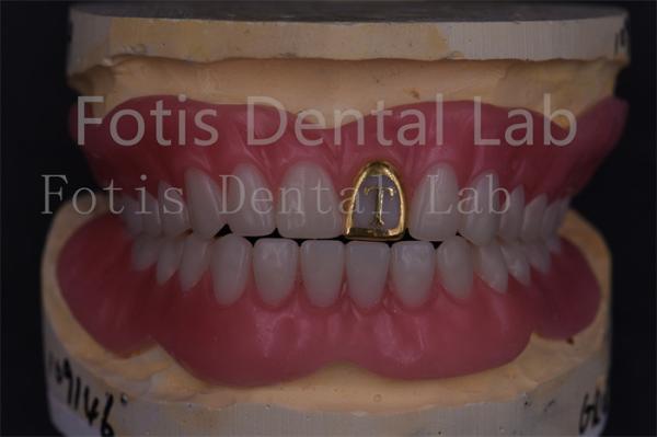 Professional Technicians Acrylic Complete Denture Fake Teeth Prosthetics