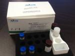 SHBG Reagent Automatic Chemiluminescence Immunoassay System Sex Hormone Binding