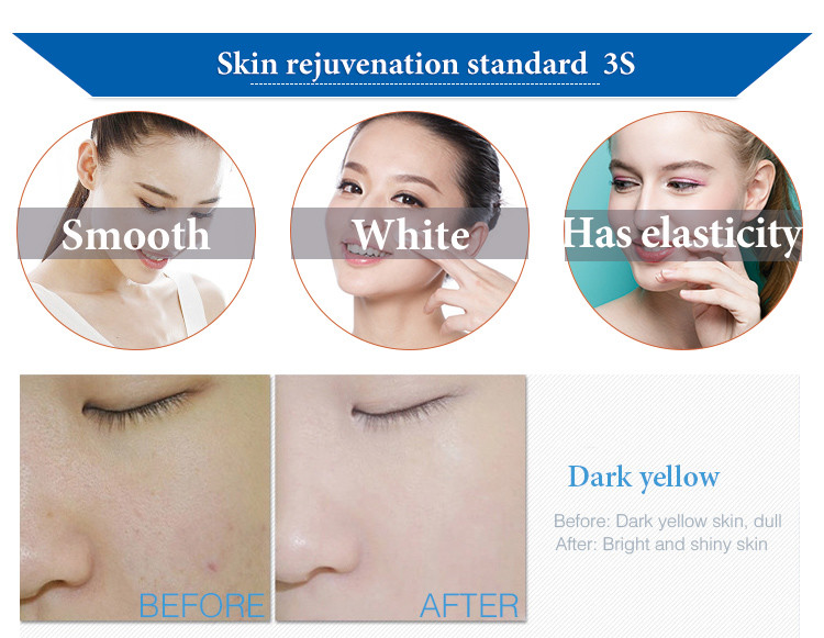 Jet Peel Deep Clean Facial Hydra Dermabrasion Machine for Skin Therapy