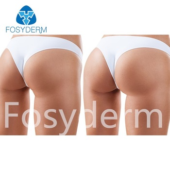 Fosyderm Hyaluronic Acid Forehead Wrinkles 1ml 2ml Injectable Filler Type