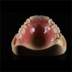 Comfortable Partial Valplast Flexible Dentures Nylon Material