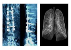 Quality Sharp Radiographic Medical X Ray Films , Mri Dr Ct Digital Dry Imaging Film wholesale