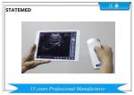 Tablet Screen Wireless Ultrasound Scanner / USB Ultrasound Probe 100 – 200mm