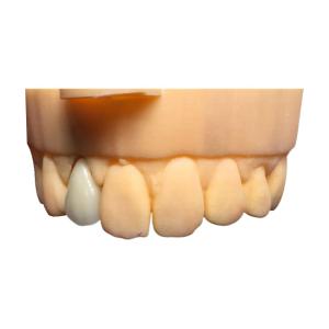 Quality Chromecast Safety PFM Dental Crown Bridge Good Biocompatibility wholesale