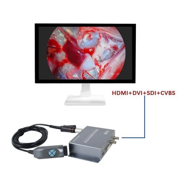 Manufacture TUYOU Integrated Portable 1080P Medical Imaging Endoscopy Camera For