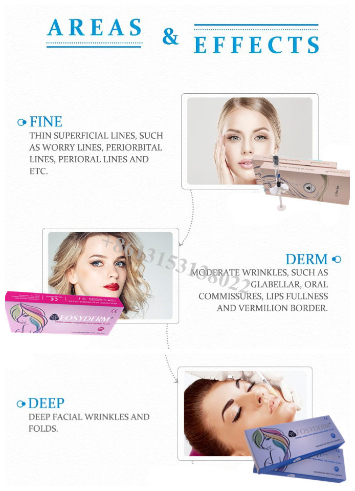 2ml Cross Linked Hyaluronic Acid Dermal Filler HA Gel Lip Filler