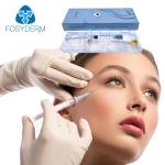 Anti Aging Fosyderm Filler Hyaluronic Acid Syringe Needle Injection