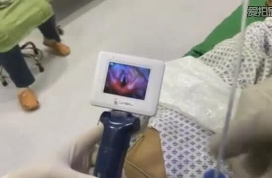 Portable Video Laryngoscope Flexible Fiberoptic Diagnostic Mac 4 Blade