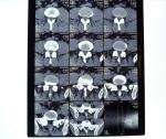 Waterproof Holographic X Ray Dry Film KND-A For Thermal Printer , AGFA 5300 /