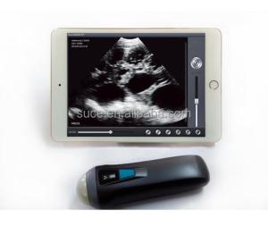 Quality Laptop color Doppler ultrasound system Uprobe-1 wholesale