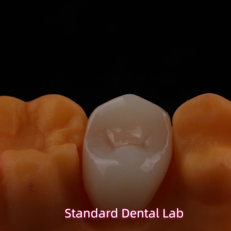 Full Contour Zirconia Crown Exceptional Strength and Esthetics No Porcelian Overlay Posterior Crown China Dental Lab