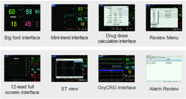 Hospital ICU 10.4 Inch Multi Parameter Patient Monitor WIFI Connection