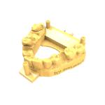DLP3D Printing High-Precision Low Shrink Scratch-Resistant Orange Restoration
