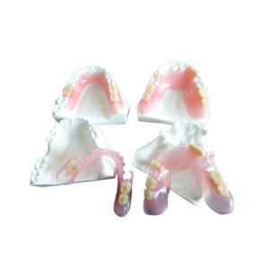 Quality Digital PFM Dental Crown Restoration wholesale